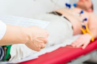 ekg serca