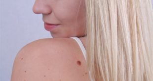 Co zrobić, by włosy rosły szybko i by były mocne i silne?