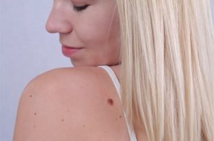 Co zrobić, by włosy rosły szybko i by były mocne i silne?