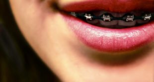 Jak wygląda pierwsza wizyta u ortodonty?