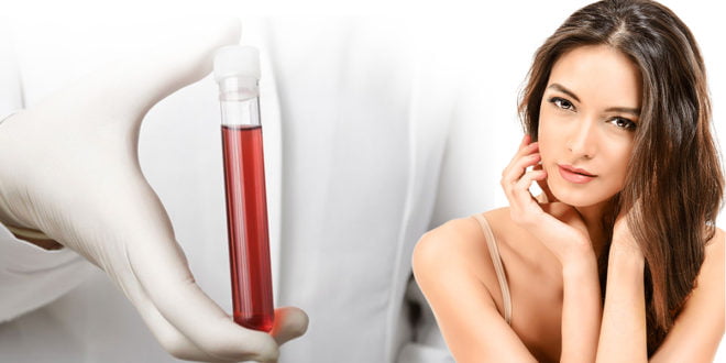 Osocze bogatpłytkowe