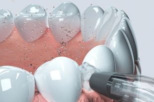 Irygator dentystyczny oclean w1