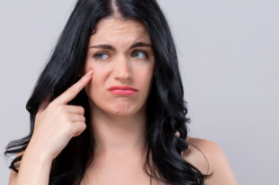 Jak walczyć z zaskórnikami?